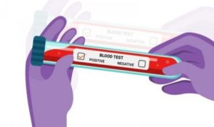 Ilustrasi Poto Rapid Test Covid 19