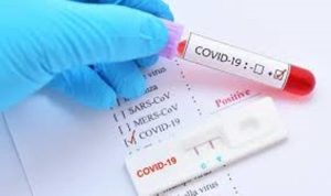 Ilusyrasi Test cepat Rapid Test Covid 19