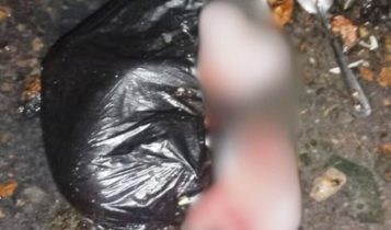 Janin bayi berjenis kelamin perempuan terbungkus di dalam kantong plastik.